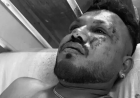 अहमदाबाद प्लेन क्रैश में चमत्कारी ढंग से बचा एक यात्री, बताया- आंखें खुली तो चारों ओर बिखरी थीं लाशें…