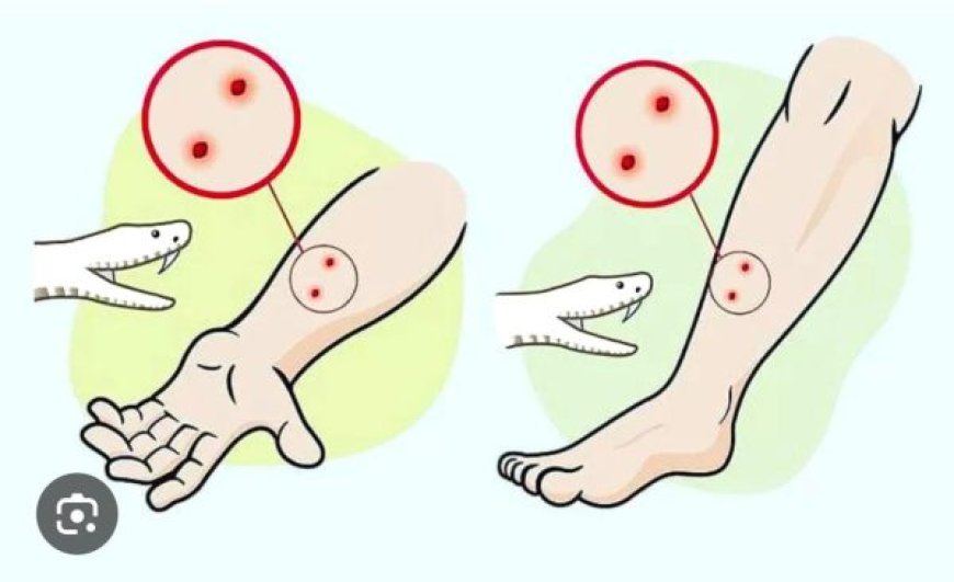 सांप डसे तो झाड़-फूंक में समय न गवाएं, तुरंत अस्पताल पहुंचे,सर्पदंश से बचने स्वास्थ्य विभाग ने जारी की एडवाइजरी