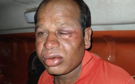 मंत्री के भतीजे पर मारपीट का आरोप, एफआईआर में नाम दर्ज न करने का दबाव