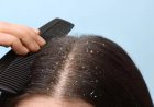Winter Hair Care: सर्दियों में डैंड्रफ और बाल झड़ने से छुटकारा पाने के 4 आसान घरेलू नुस्खे