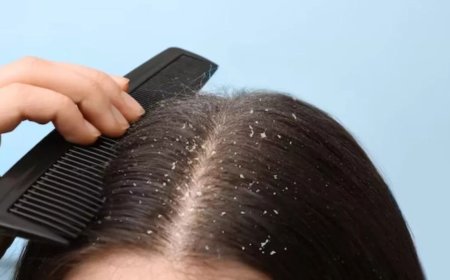 Winter Hair Care: सर्दियों में डैंड्रफ और बाल झड़ने से छुटकारा पाने के 4 आसान घरेलू नुस्खे