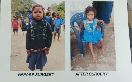 चिरायु एक वरदान- हृदय रोग से पीडित दिव्या ऑपरेशन के बाद जी रही है सामान्य जिन्दगी