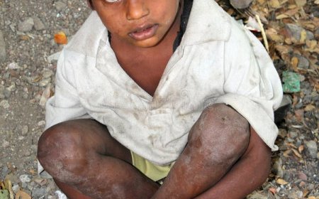 कर्नाटक हाईकोर्ट का अहम निर्देश: बाल भिखारियों की मदद के लिए नोडल अधिकारी नियुक्त करे राज्य सरकार