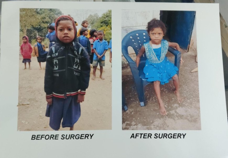 चिरायु एक वरदान- हृदय रोग से पीडित दिव्या ऑपरेशन के बाद जी रही है सामान्य जिन्दगी