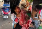 मुंगेली नाका स्कूल के सामने तेज रफ्तार स्कूटी सवार युवक ने साइकिल सवार महिला को मारी जोरदार टक्कर, हालत गंभीर