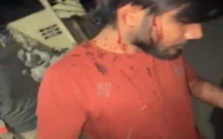 आरोपी ने लोहे की कुर्सी से स्वयं खटीक के सिर पर जानलेवा हमला कर उसे बुरी तरह घायल कर दिया।