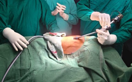 सिम्स में पहली बार VATS तकनीक से टीबी जनित प्लूरल इफ्यूजन का सफल उपचार, अब जटिल फेफड़ा सर्जरी बिलासपुर में ही संभव