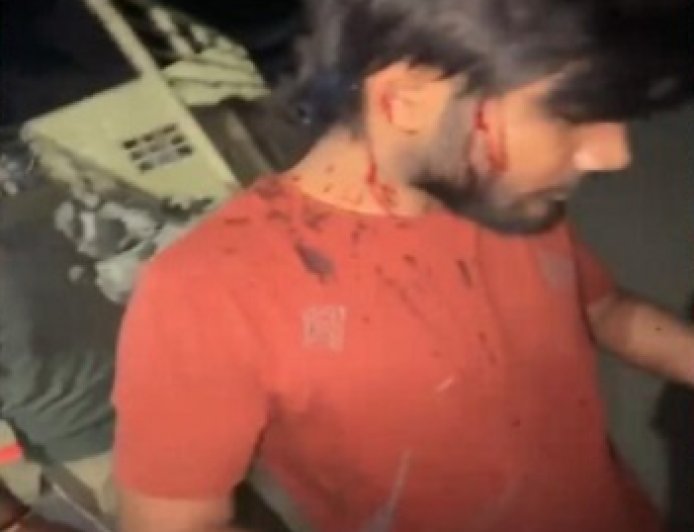 आरोपी ने लोहे की कुर्सी से स्वयं खटीक के सिर पर जानलेवा हमला कर उसे बुरी तरह घायल कर दिया।