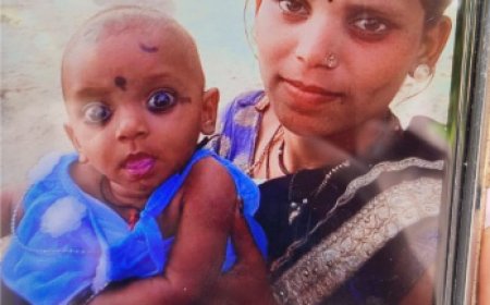 आग में झुलसी दो साल की मासूम, इलाज के दौरान मौत,,