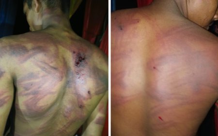 बिलासपुर में आधी रात वारदात: महाराणा प्रताप चौक पर पिकअप चालक से मोबाइल और चांदी की चेन लूटी, 3 स्कूटी सवारों पर FIR