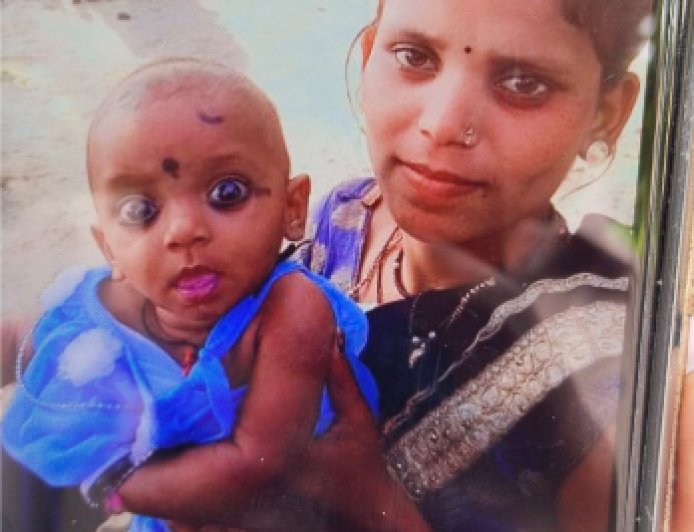 आग में झुलसी दो साल की मासूम, इलाज के दौरान मौत,,