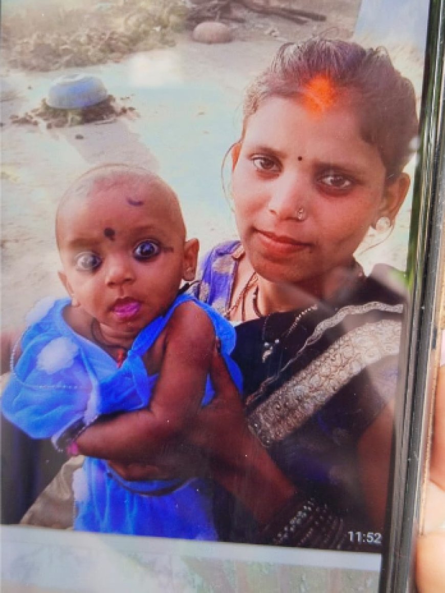 आग में झुलसी दो साल की मासूम, इलाज के दौरान मौत,,